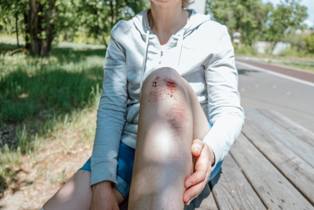 Uprawiając parkour traceurs narażony jest na kontuzję kolan, wczesne stosowanie suplementu kolagenu ochroni  stawy kolanowe przed uszkodzeniem.